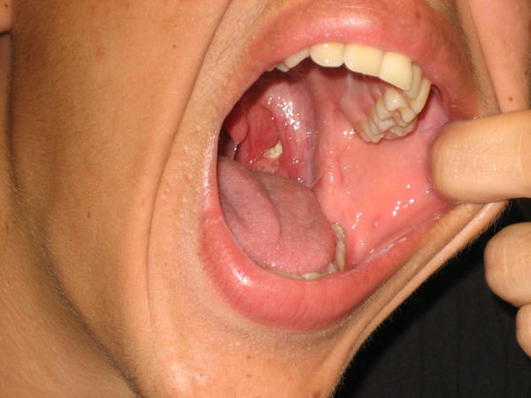 bajamet